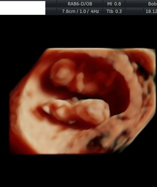 avatar Baby Moments Ltd